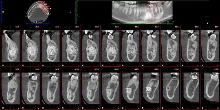 Oral Surgery